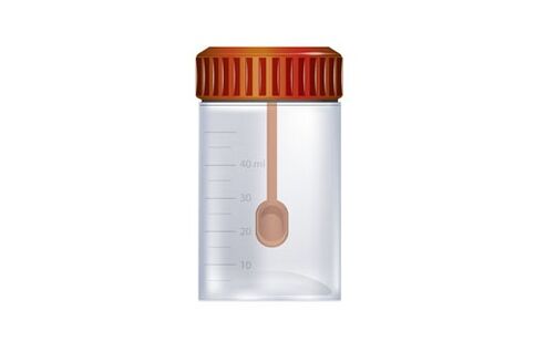 Behälter zum Sammeln von Kot für Parasitentests