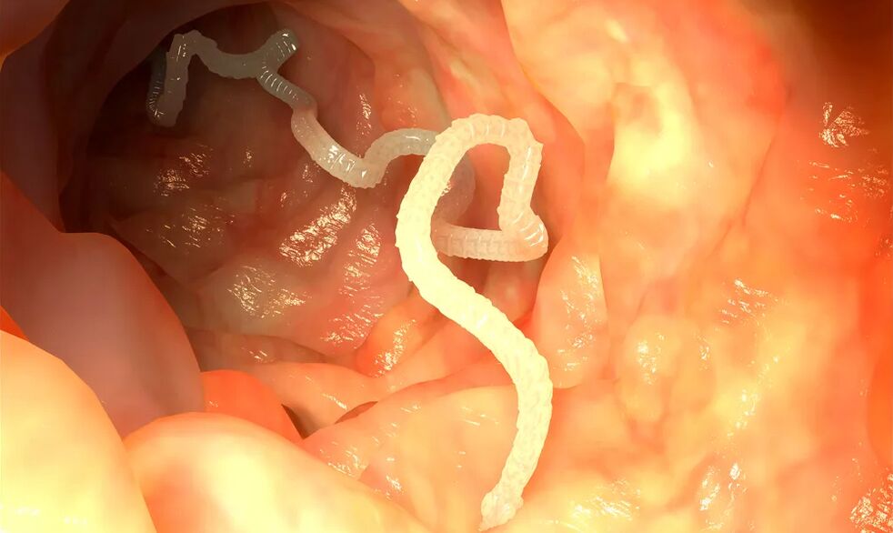 Luminalwürmer infizieren den Darm. 