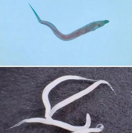 Arten von Parasiten im menschlichen Körper