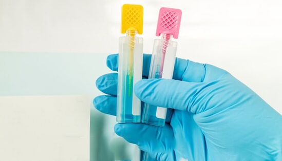 Parasiten diagnostische Methoden
